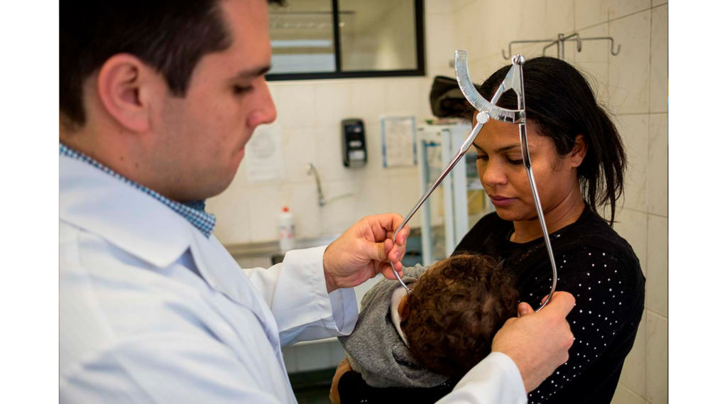 Cranioestenose x Assimetria posicional: Conheça diferenças