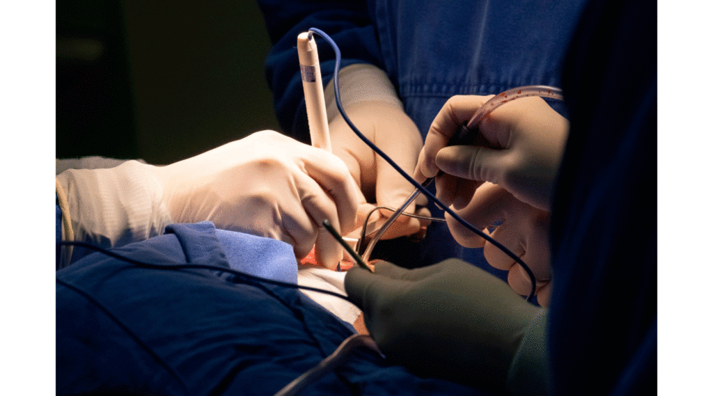 Tudo sobre cirurgia de reconstrução de orelha com cartilagem costal