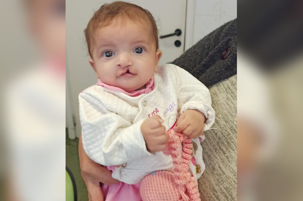 Dia da Fissura Labiopalatina