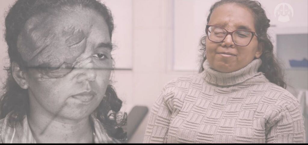 Anomalia Craniofacial e Tumores de Face: A História de Inez Nascimento Santos