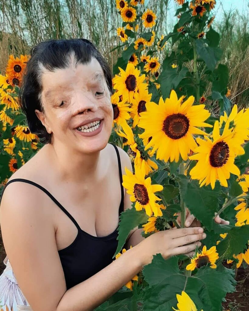 Histórias de Superação no Hospital Sobrapar