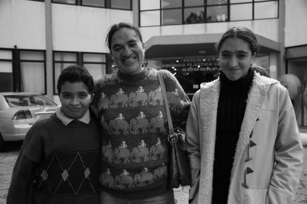 Como o Hospital Sobrapar Mudou a Vida de Laíde Nunes com Síndrome de Crouzon