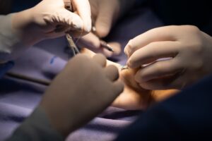 Cirurgia Plástica de Crânio e Face